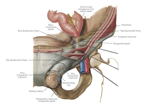 Βουβωνοκήλη