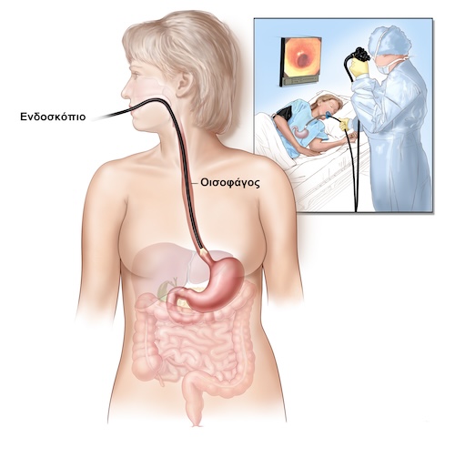 Οισοφαγοσκόπηση